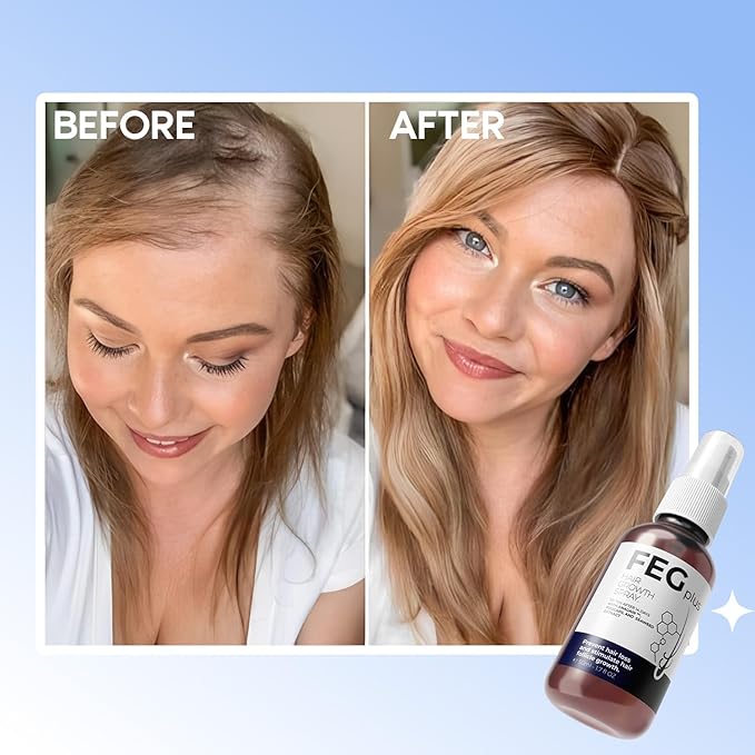 FEG Plus Hair Growth Spray - Rosemary Beard & Hair Growth Serum (50ml), Rosemary Extract Serum Hair Spray, Minoxidil 5% Solution for Hair Growth Booster, Revitalise Hair and Beard Regrowth
